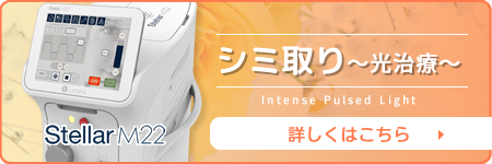 シミ取り(光治療)・ステラM22